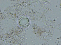 Pythium