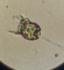 Vorticella