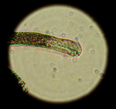Gastrotricha