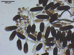 Phragmidium violaceum