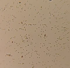 Beauveria bassiana