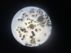 Foraminifera