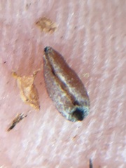 Pedicularis semibarbata