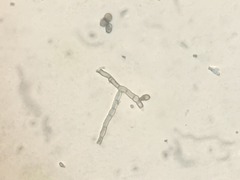 Calicium viride image