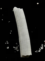 Scaphopoda