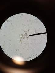 Trichonympha