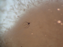 Amerosporium