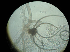 Amerosporium