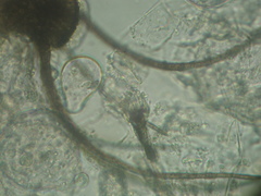 Amerosporium