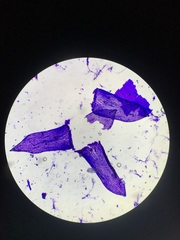 Sphagnum flavicomans