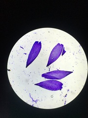 Sphagnum flavicomans