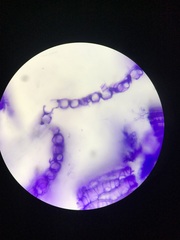 Sphagnum flavicomans