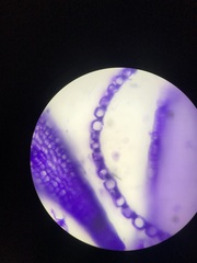 Sphagnum flavicomans