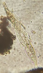 Alyxoria varia