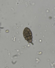 Alternaria
