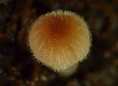 Setulosi