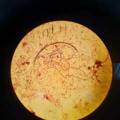 Streptomyces