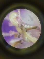 Pleroma heteromallum