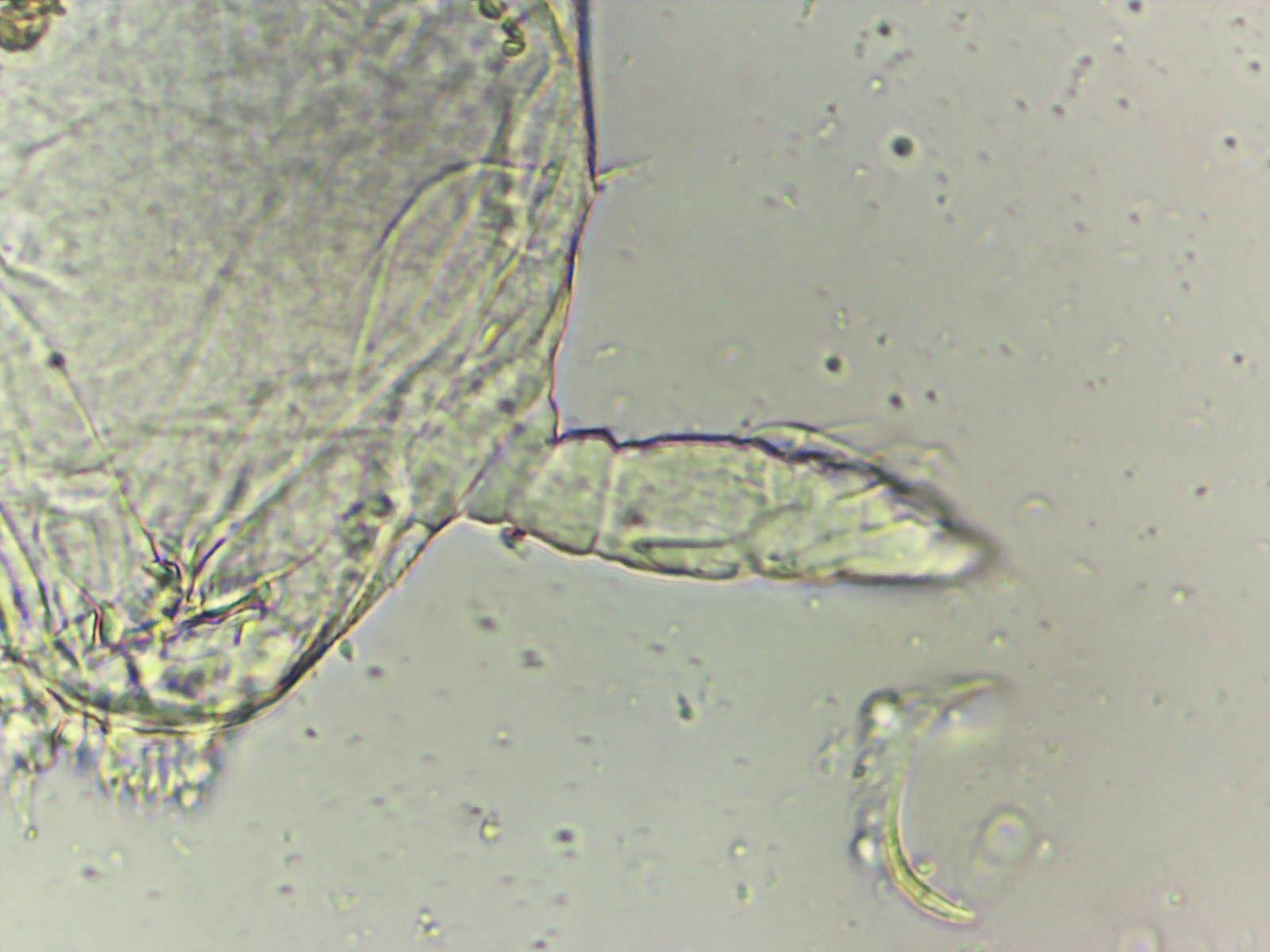 Megalothorax incertus C.Börner, 1903