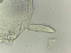 Megalothorax incertus