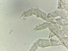 Megalothorax incertus