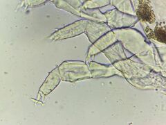 Megalothorax incertus