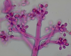 Botrytis