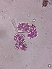 Botrytis