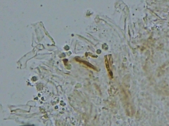 Trechispora