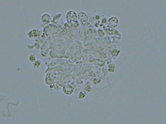 Trechispora
