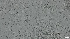 Phlebia