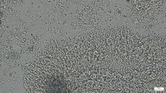 Phlebia