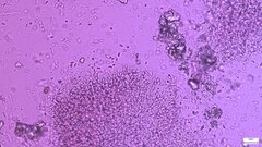 Phlebia