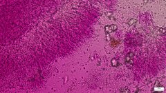 Phlebia