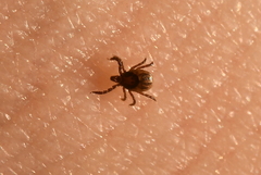 Ixodes ricinus