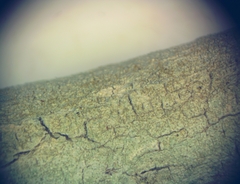 Pertusaria coccodes