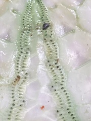 Euechinoidea