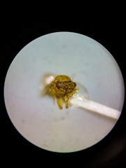Insnesia extrema