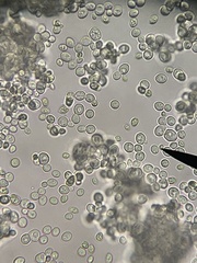 Saccharomyces cerevisiae