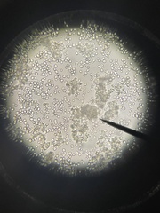 Saccharomyces cerevisiae