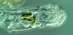 Cephalodella forficula