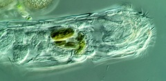 Cephalodella forficula
