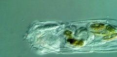 Cephalodella forficula