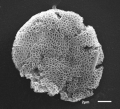 Cercozoa