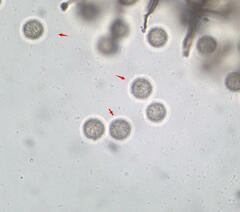 Stemonitopsis hyperopta