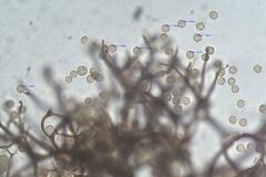 Stemonitopsis hyperopta