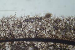 Stemonitopsis hyperopta