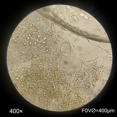 Ciliophora