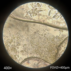 Ciliophora