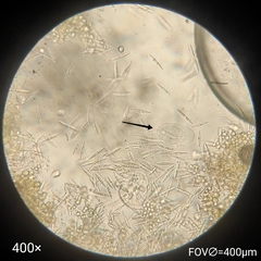 Protozoa